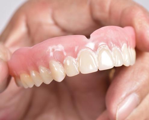 Dentiera Monza